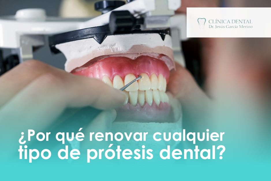 cuando renovar la protesis dental férula de descarga retenedor ortodoncia