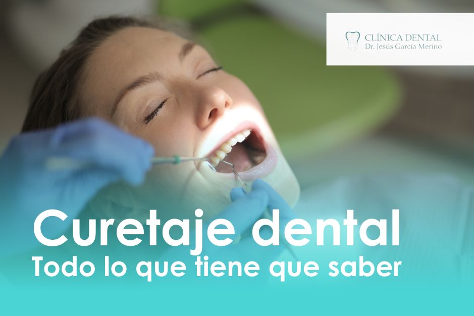 que es el curetaje dental dentista jaen clinica dental jaen jesus garcia merino