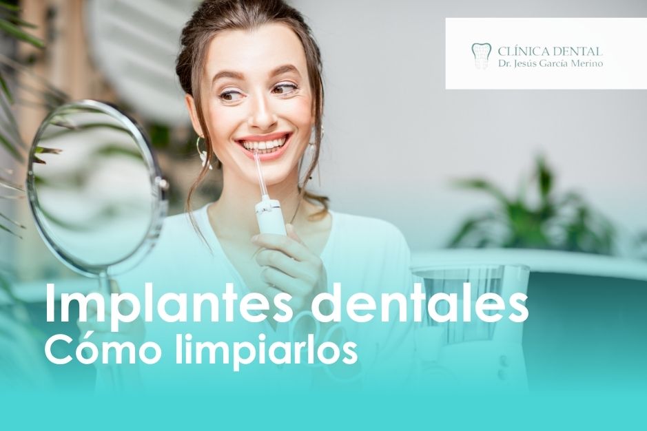 Cómo limpiar mis implantes dentales clinica dental jaen dentista implantologia